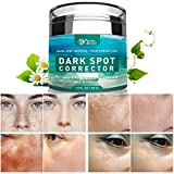 Dark Spot Remover for Face, Hyperpigmentation Treatment, Melasma, Freckle, Sun Spots Removal for All Skin Types Dark Spot Corrector for Men and Women